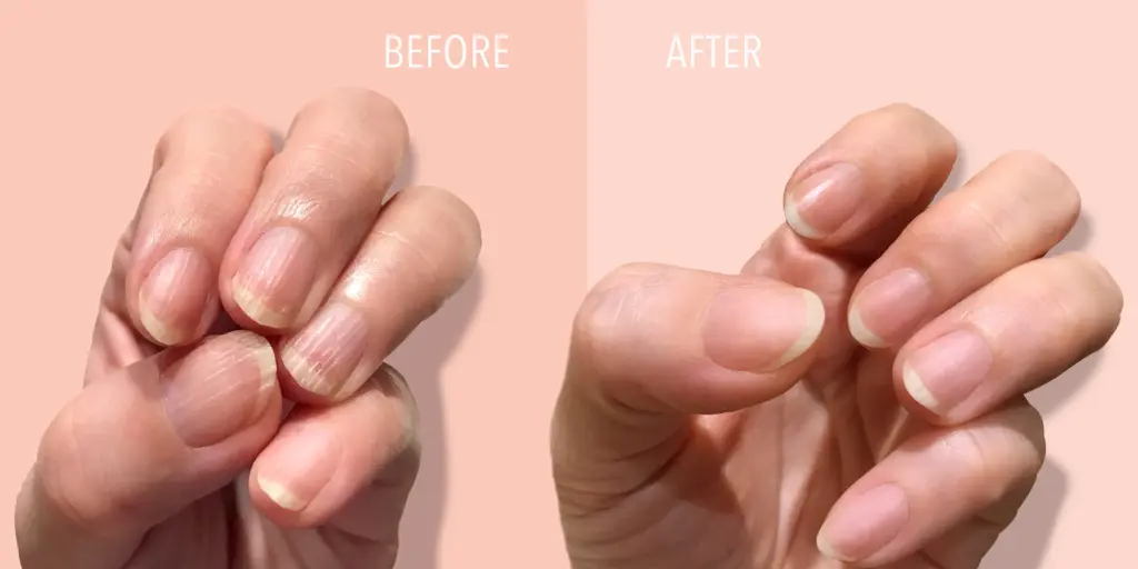How To Get Rid Of Nail Ridges