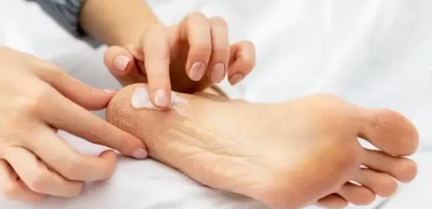 Best Foot Cream For Athlete's Foot of 2026 UK